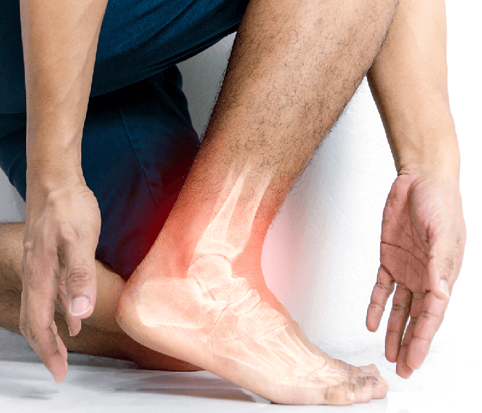 Επιστραγαλίδα Ελαστική Με 2 Δέστρες (Orthopedic)